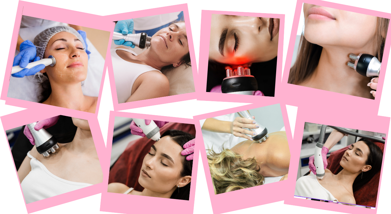 RF Treatments
