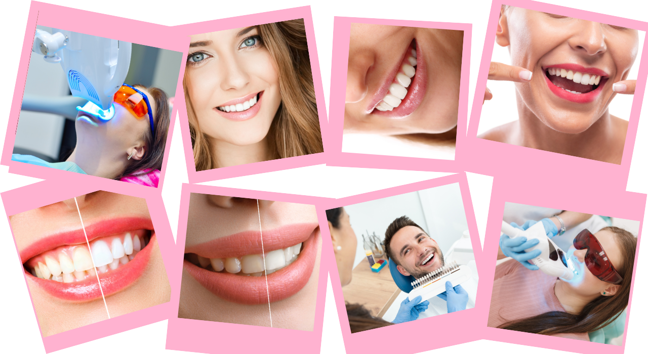 teeth whitening